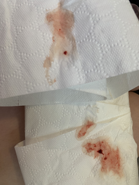 TW BLOOD PIC
