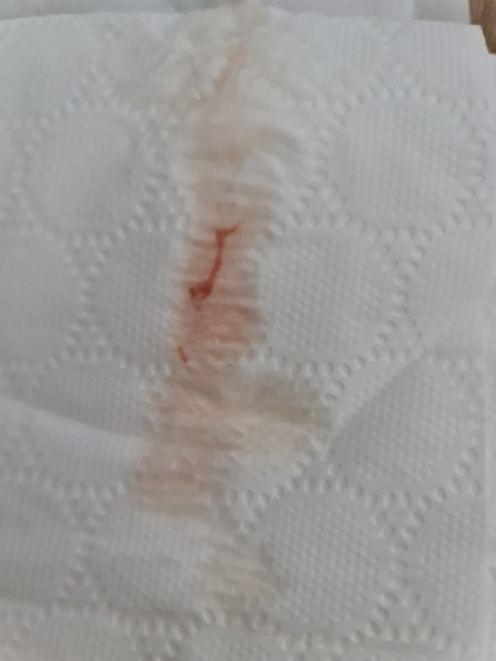 Worried and need help