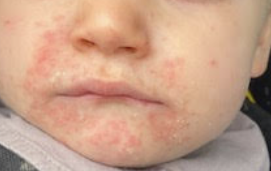 Help / advise with skin condition