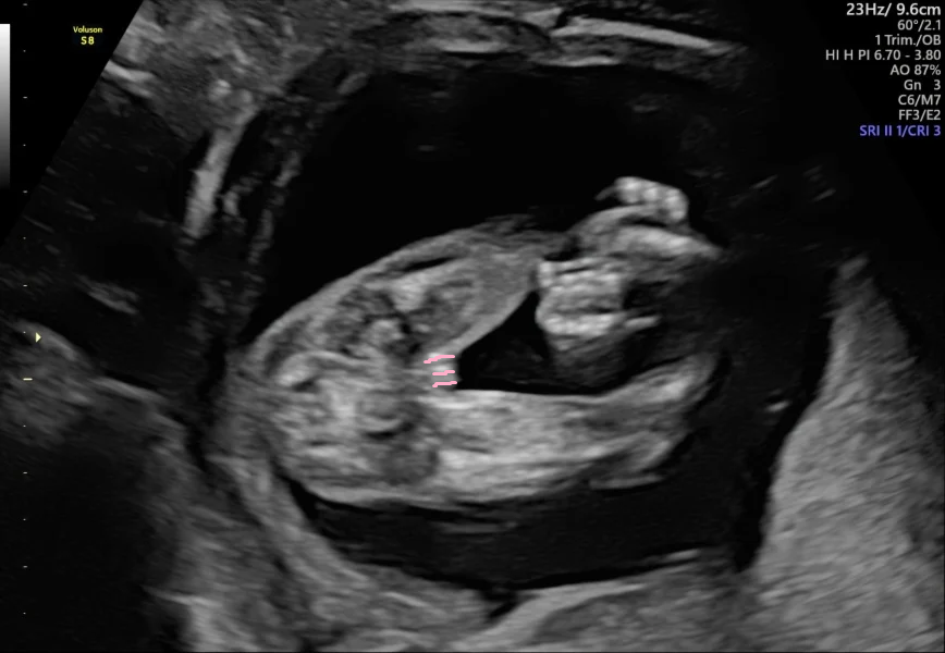Boy or girl?