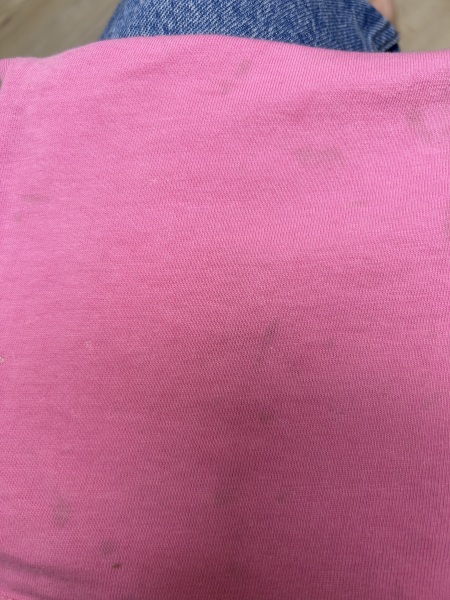 Is this staining from washing machine?!