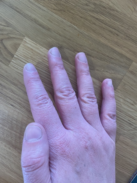 How can I improve the look of my hands?
