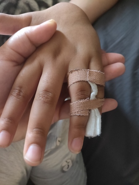 Finger fractured