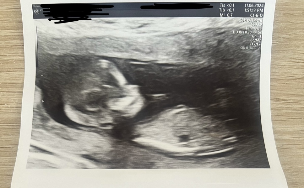 What the nub ?!?? Gender guesses please ❤️