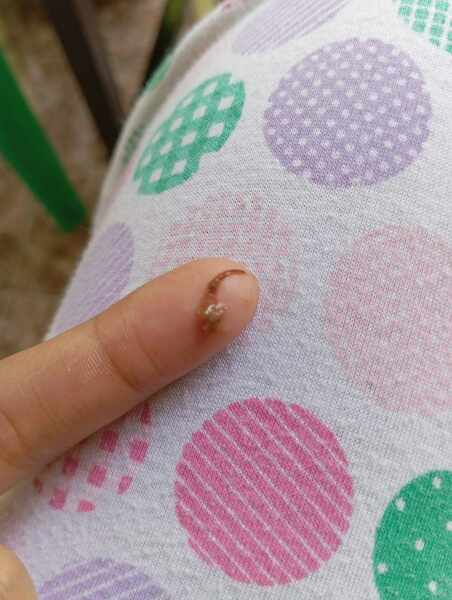 Brown like discharge