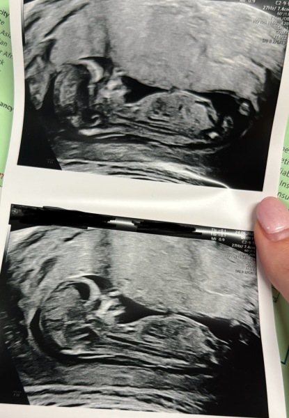 TTC after chemical - anyone with me?