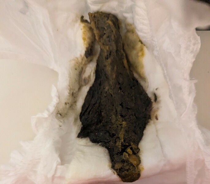 Is this black poo?