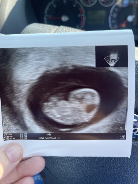 Due Jan 2025