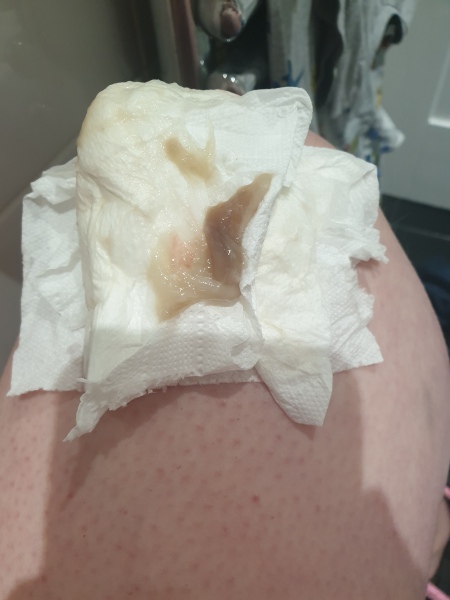 TMI PHOTO INC!! Is this my mucus plug?