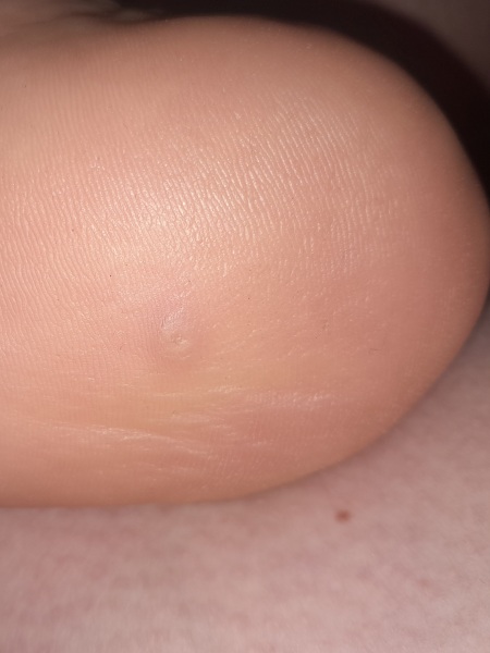 What is this in my Heel?  Pic inc