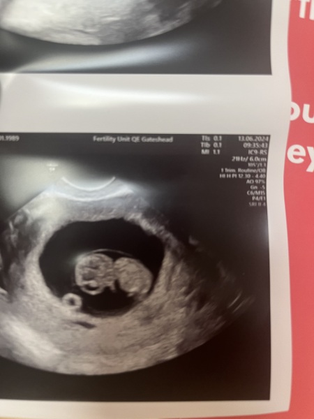 BFP after IVF - anyone want to join me in the wait for first scan?