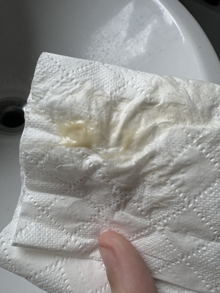 8 weeks - discharge (photo)