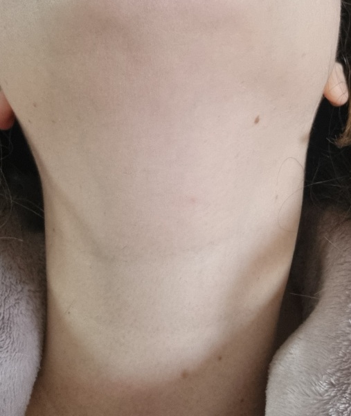 Continuing Mounjaro...part 13