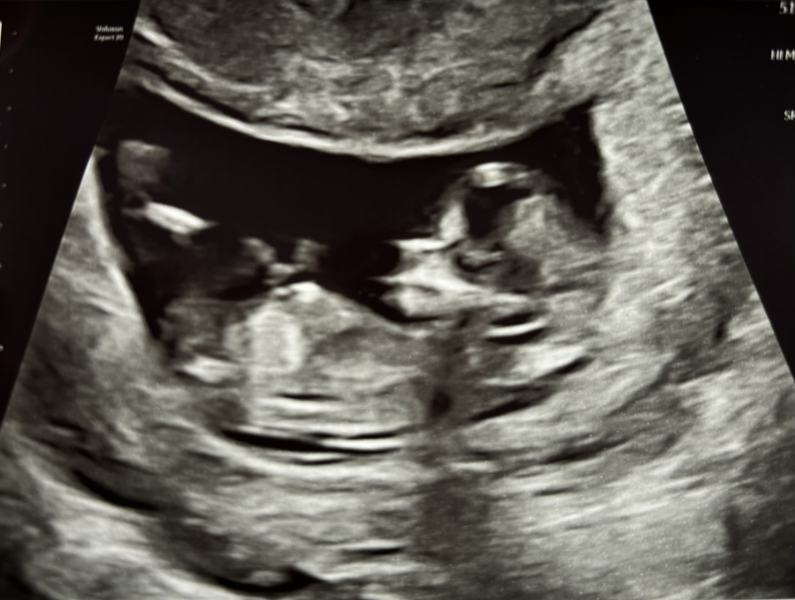 Due Jan 2025