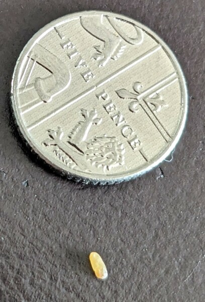 Blackhead from my teenager