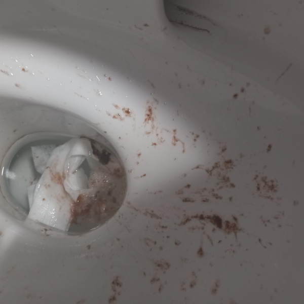 Child's vomit - blood?