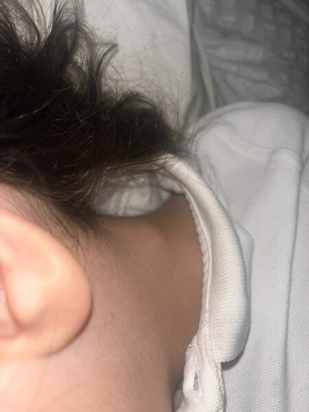 Lymph node my son is 5 years old