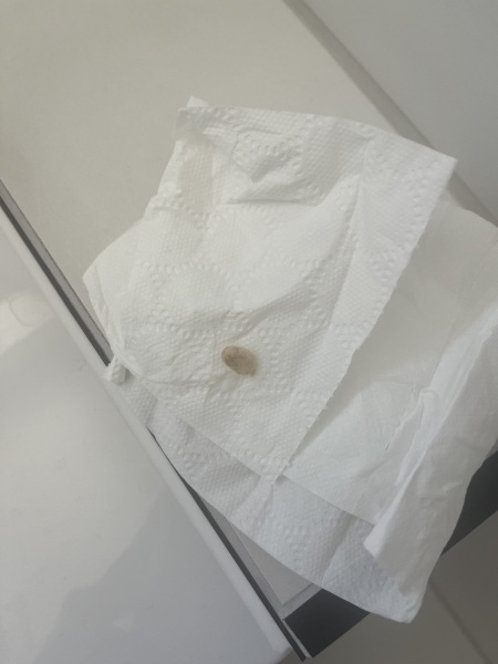 What is this?