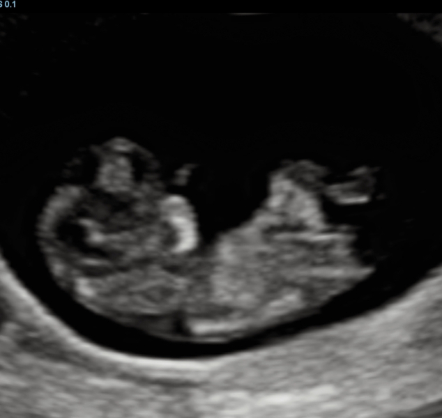 Baby boy or girl??