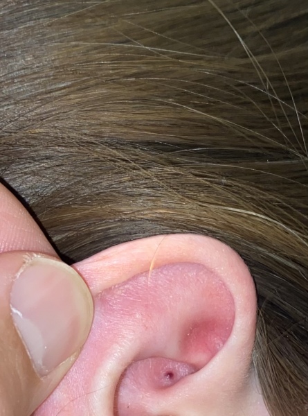 To be so scared about this spot in my ear.