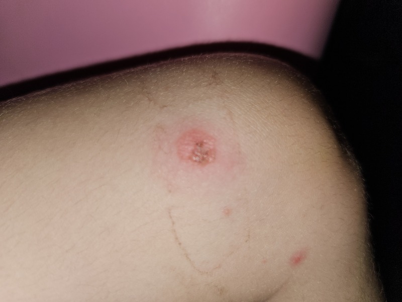 What is going on with DD's skin? Should I be worried?? Pic Attached