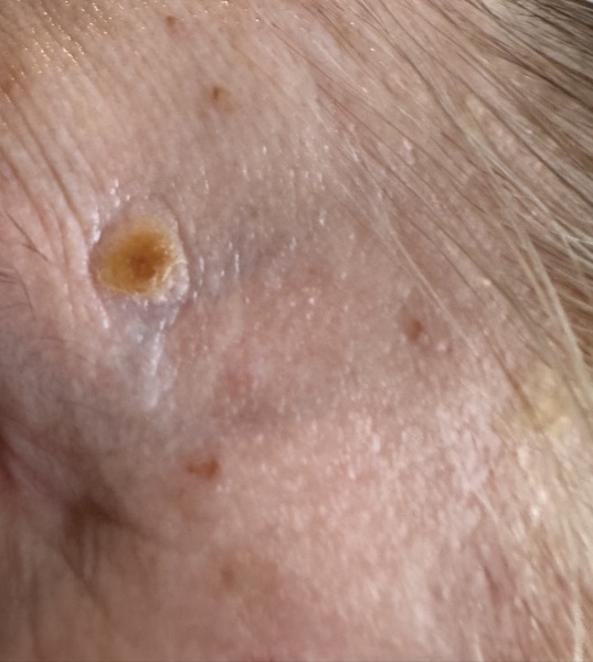 Does this look like I need to see a doctor?