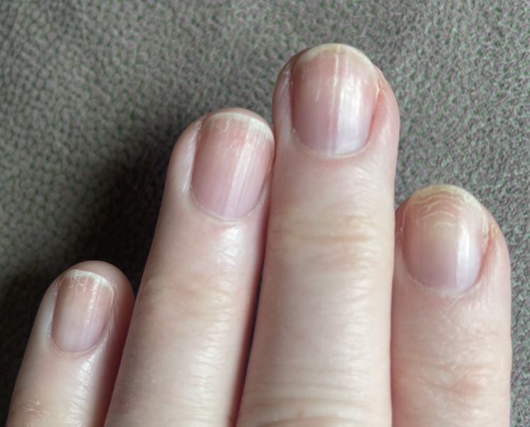 Please can anyone advise on my nails