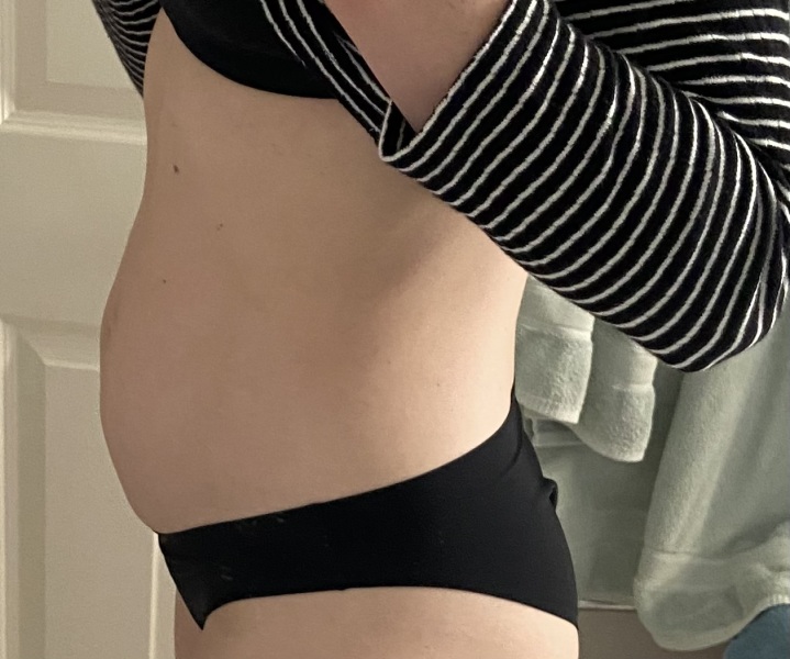 Lower belly seems a funny shape