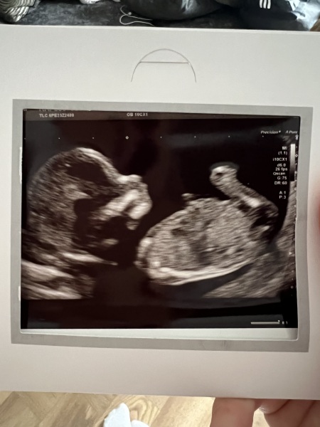 Gender guesses