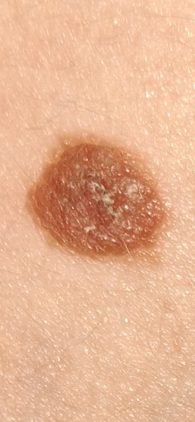 Would this worry you?