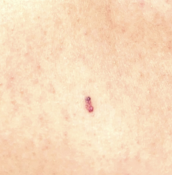 Any idea what this is on son's leg?