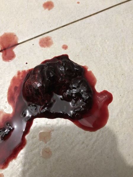 Is this my baby? I’m 4 weeks