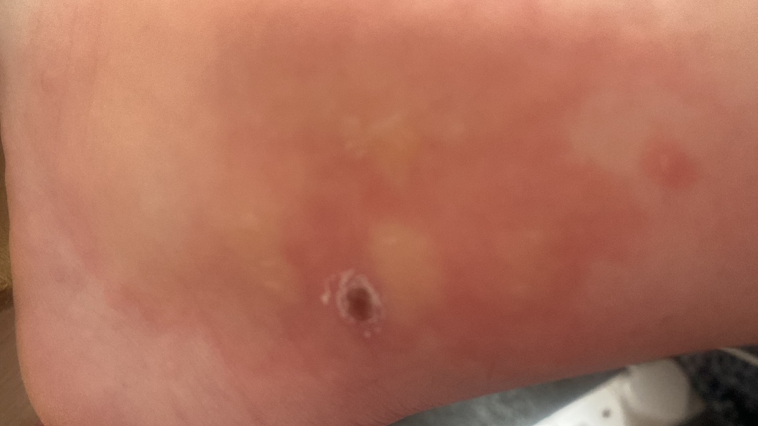 Should I be worried about this?