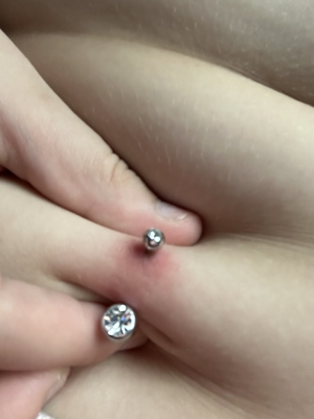 Does my belly button piercing look infected? (pic)