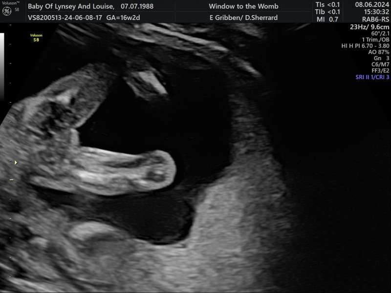 Window to the womb