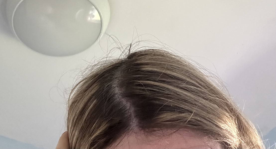Hairdresser refused to do my hair ....