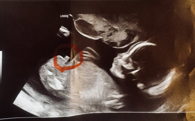 Have I ruined the gender surprise? :(