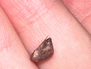 TMI what is this looks like stone in vulva area? **pics in comments**