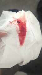 4 weeks 2 days and bleeding