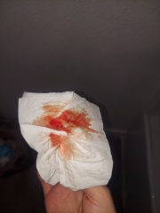 Implantation bleeding or change in menstrual cycles??