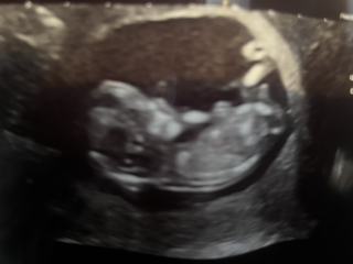 Boy or girl?