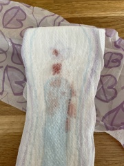 5 weeks and bleeding - advice please