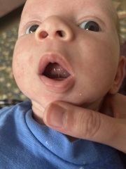 Tongue Tie?