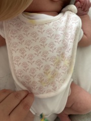 Yellow baby sick. 7 day old baby
