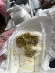 CMPA? *Graphic Poo Pic!*