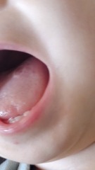 Is this blister in babys tongue? (Pic)