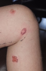 What is going on with DD's skin? Should I be worried?? Pic Attached