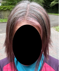 Has anyone "embraced the grey" successfully?