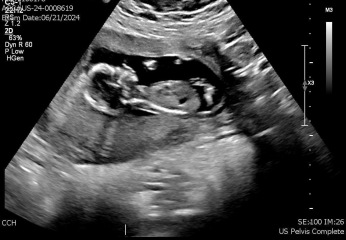 Is this a girl or a boy?