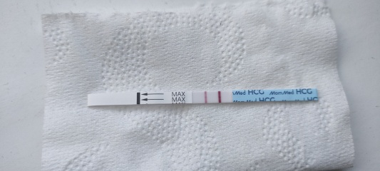 Lighter lines 5 weeks - should I be worried?